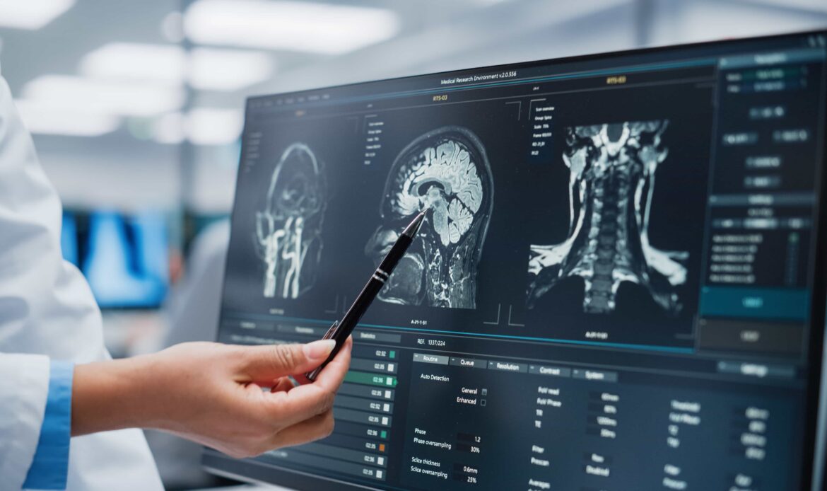 Doctor analyzing brain MRI scans on computer screen in modern medical facility. Doctor analyzing brain MRI scans on computer screen in modern medical facility.