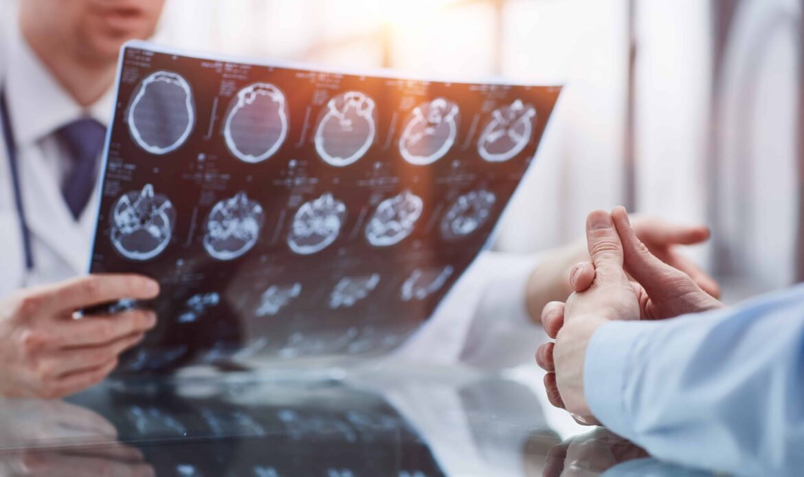 Doctor reviewing brain scan results with patient during medical consultation Doctor reviewing brain scan results with patient during medical consultation