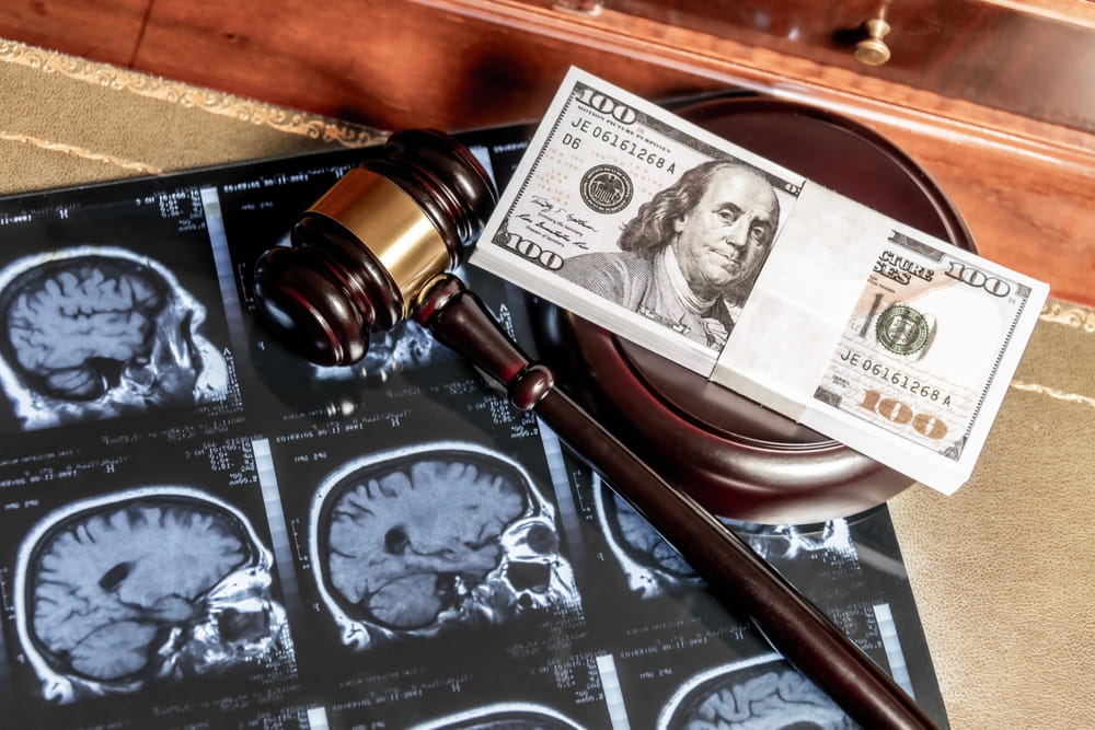 Gavel and money over medical scans illustrating compensation and damages in a Texas medical malpractice lawsuit