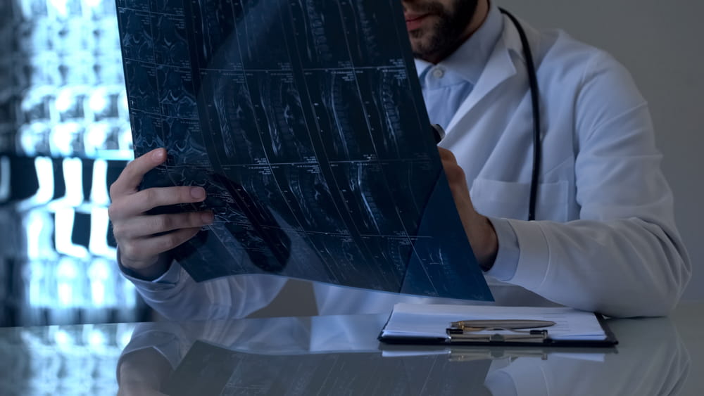Doctor reviewing diagnostic imaging related to a spinal cord injury claim in Colorado